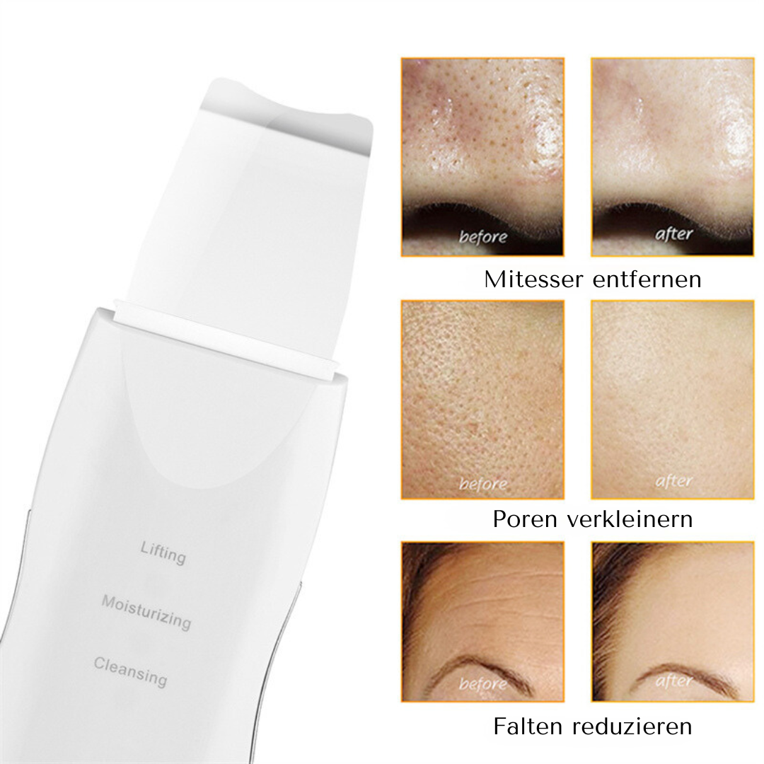 Ultraschall Hautschaber | Intensive Tiefenreinigung für Deine Skincare-Routine