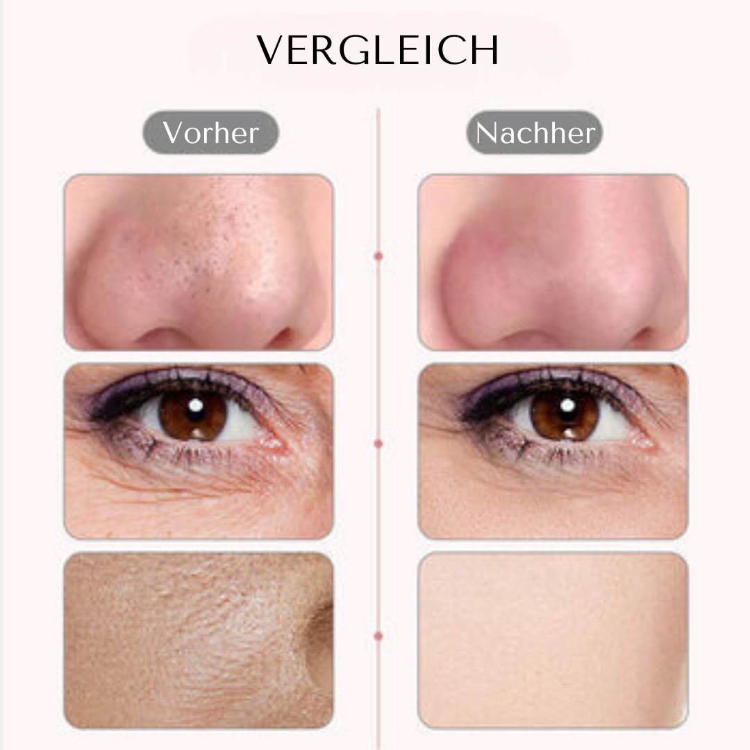Ultraschall Hautschaber | Intensive Tiefenreinigung für Deine Skincare-Routine